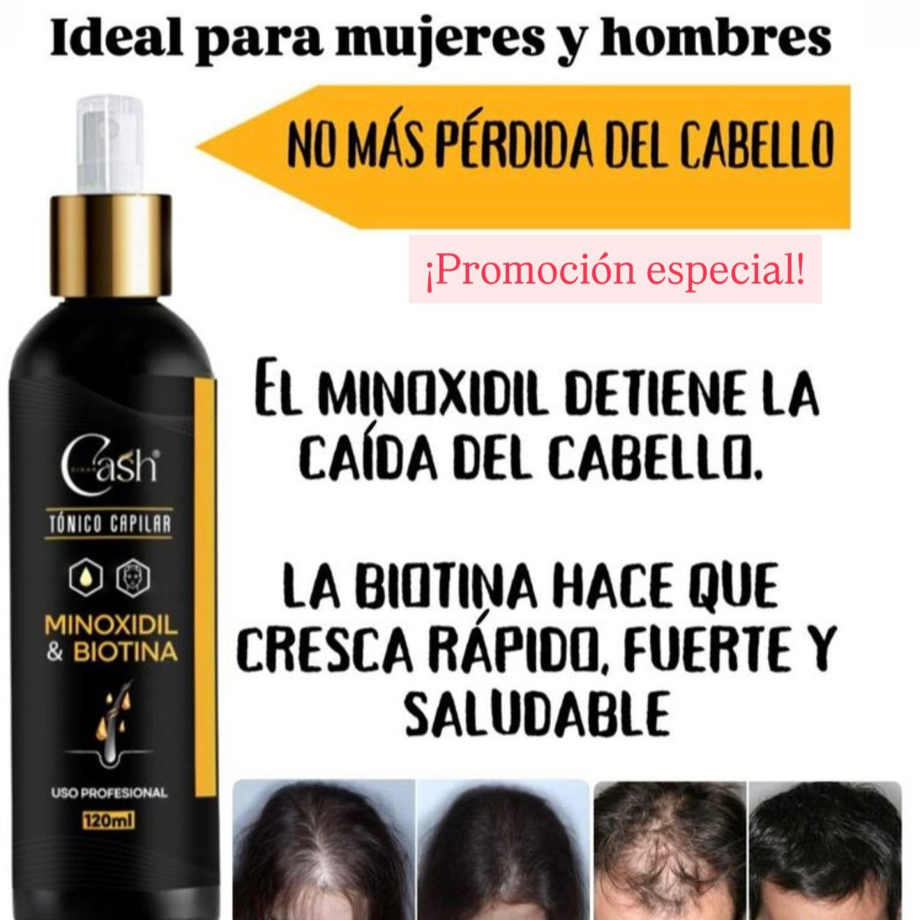Ultra Acelerador Tónico Capilar - Fórmula Avanzada 40% OFF