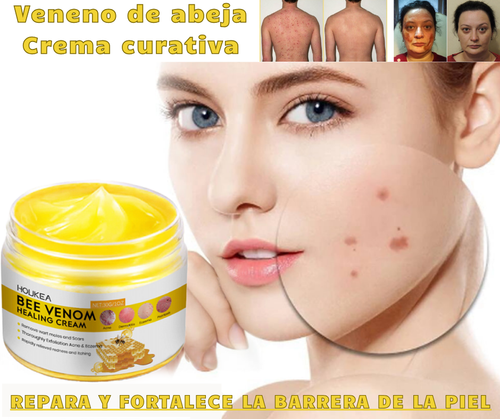 VENENO DE ABEJA - La fórmula curativa que todo el mundo debería tener en sus casas